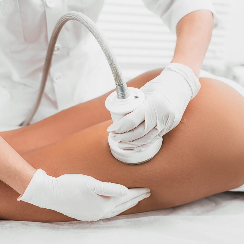 woman having cavitation, procedure removing cellulite on her buttocks , lifting buttocks